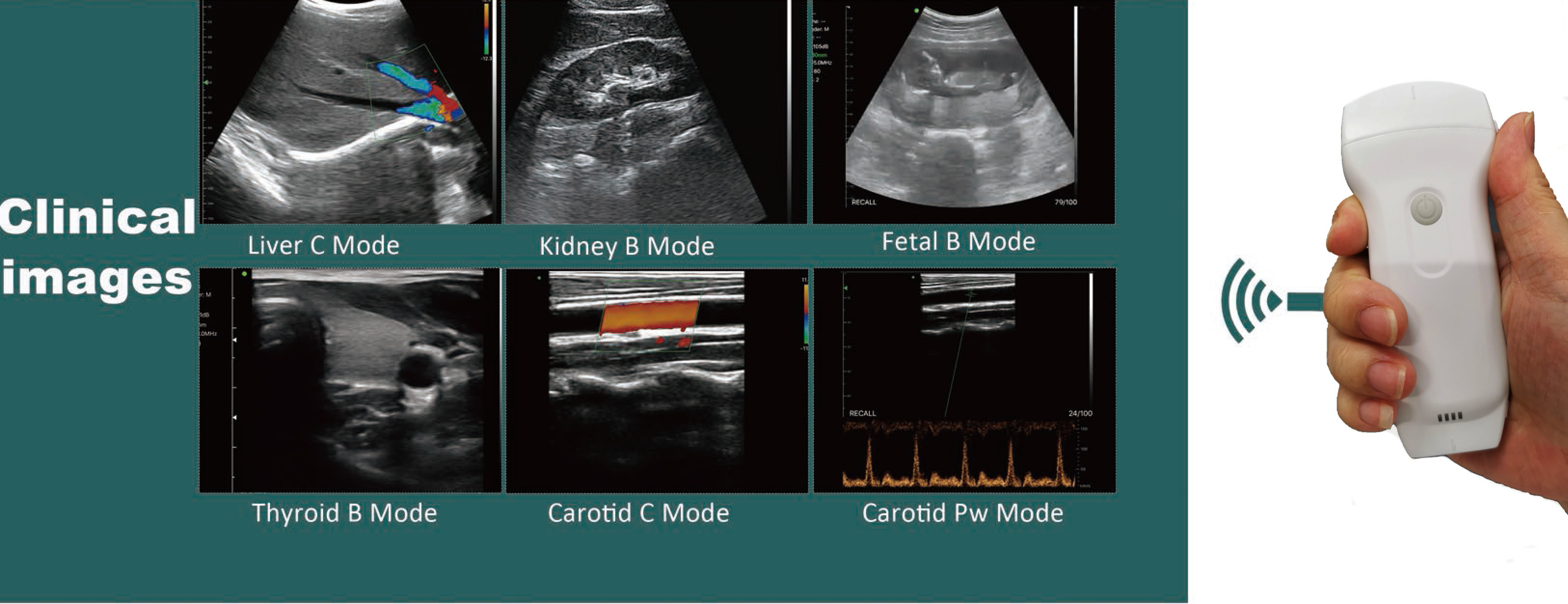 GH G10RL USB Portable Color Doppler Ultrasound Transducer Machine