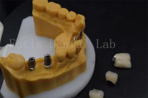 Quality High Durability Tooth Implant Crown Easy To Adjust Dental Implant Guide Sleeves wholesale