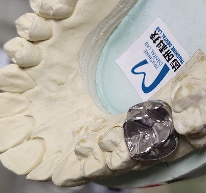 Full Cast Base Metal Alloys Dental Crown