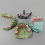 Flexibility Meets Invisibility Dental Flexible Resin for Full Dentures