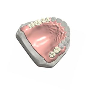 Quality Removable Dental Partial Denture Natural Color 3D Dental Model Customized wholesale