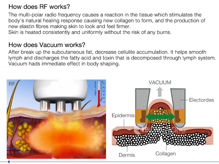 DM19-2 RF 80k Vacuum Cavitation Machine Body Slimming Cellulite Reduction