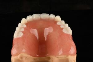 Quality Natural Looking Acrylic Full Dentures Artificial Acrylic Teeth For Long Lasting Comfort wholesale