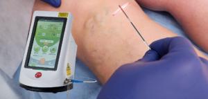 Quality Berylas Surgical Laser Equipment Pulse Mode No Stitches wholesale