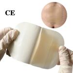Odorless Soft Hydrocolloid Wound Dressing Emergency Adhesive For Emergency