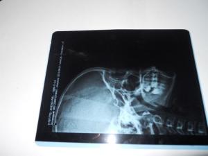 Quality KND-A Environment friendly Medical Dry Imaging Film For X Ray Examination On AGFA 5300 wholesale