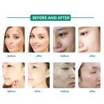Portable Facial Beauty PDT LED Light Therapy Machine ABS Material
