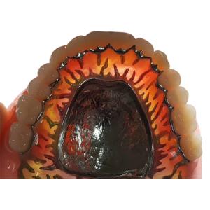 Full Removable FDA 3014652903 Composite Resin Crown Denture Teeth