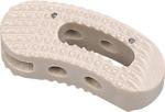 5 Degree TLIF Peek Cage II Banana Shaped Spinal Cage Fusion