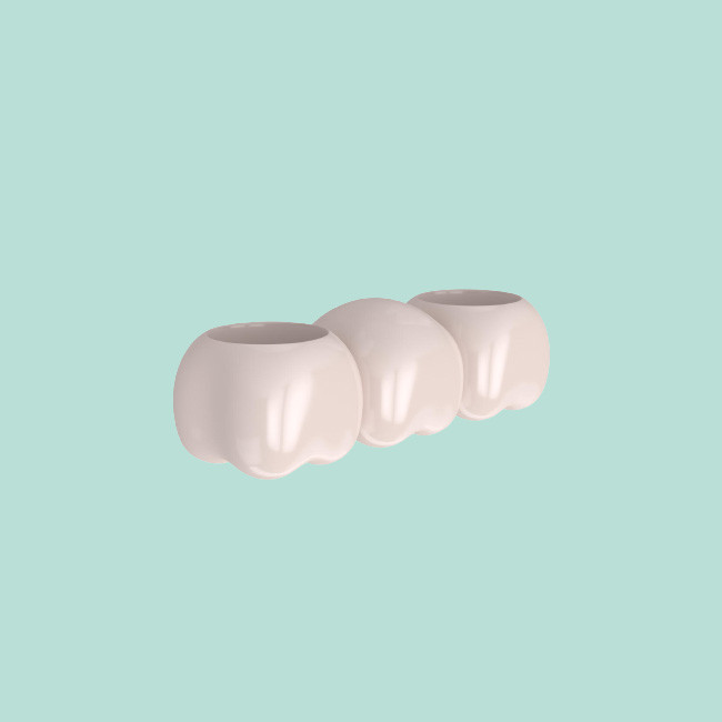 Porcelai CrownRealistic Color Stable Color Not Easy To Break Porcelain