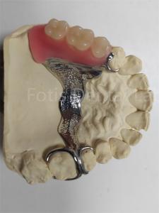 Quality Durable Odor Resistant Removable Partial Denture Highly Adjustable wholesale