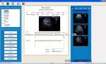 colorful portable Veterinary Color Doppler Ultrasound with 3 probes