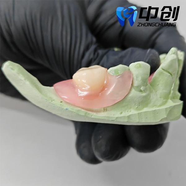 Cheap Fast Production Seedling Simulation Resin for Enhanced Patient Experience and Aesthetics for sale
