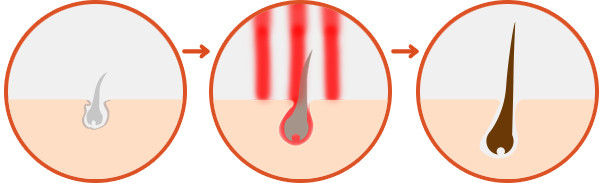 Microcurrent Probe Hair Growth Laser Comb , Low Level Laser Hair Therapy