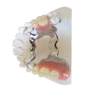 Quality FDA PFM Dental Bridge Good Biocompatibility 3D Printing Dental Models wholesale