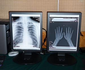 Quality medical high quality 2MP Color medical display wholesale