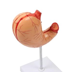 Quality Anatomy Human Organs Gastric Diseased Dissection Stomach Teaching Model wholesale