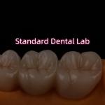 High Translucent PFZ Layered Zirconia Bridge Porcelain Ceramic Posterior