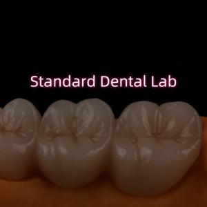 Quality High Translucent PFZ Layered Zirconia Bridge Porcelain Ceramic Posterior wholesale