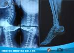 Radiology Blue Inkjet Medical X - ray Film Waterproof Inkjet Printing Film