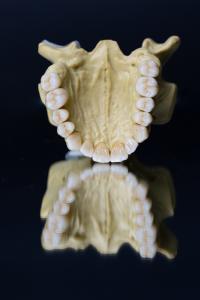 Quality Dental Lab Porcelain Zirconia Dental Crown 5 Stars Esthetics wholesale
