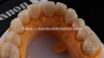Layered Dental Zirconia Crown And Bridge Translucency 3D PRO Zirconia Porcelain