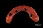 Lightweight Comfortable Fit Acrylic Dental Denture Finish Professional