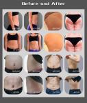 50-60hz Fat Freezing Body Sculpting Machine EMS Muscle Stimulation Machine