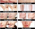 755nm 808nm 1064nm Multifunctional Beauty Machine Pico Nd YAG Laser With RF