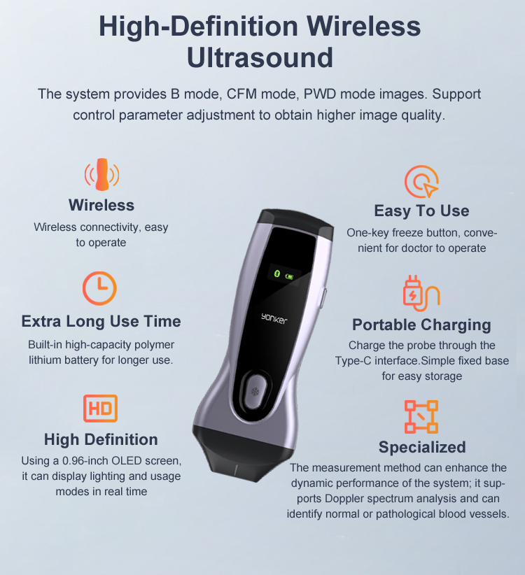Yonker Pocket Veterinary Ultrasound Scanner Portable Handheld WiFi Color Wireless Ultrasound Probe Vet for Animal Cat Pet Dog