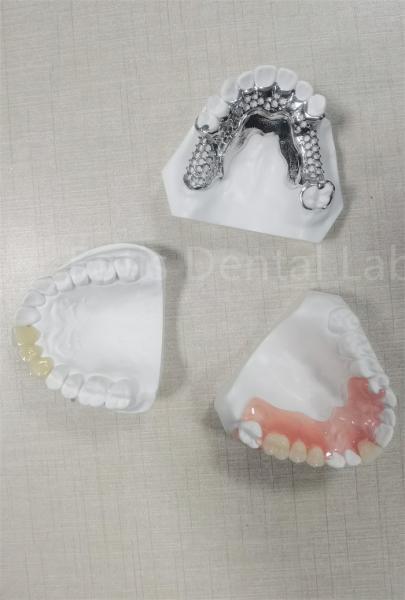 Long Lasting Flexible Removable Partial Denture Easy Cleaning Replace Missing
