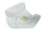 Durable FDA All-Ceramic Dental Crown Veneer Inlay Onlay Similar