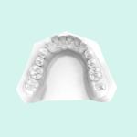 High Temperature Resistant Orthodontic Model Dental Resin 3d Printing