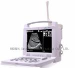 Labtop Ultrasound Scanner Machine with 2 connectors
