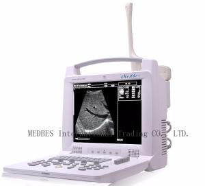 Quality Labtop Ultrasound Scanner Machine with 2 connectors wholesale