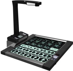 Quality Hospital 16MP HD Lens CT Film scanner price wholesale