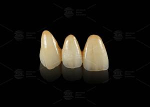 Quality Durable Hypoallergenic EMAX Bridge Extreme Esthetics Emax Dental Bridge wholesale