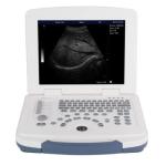 ON SALE!!! Portable full digital laptop B&W ultrasound scanner for hospital