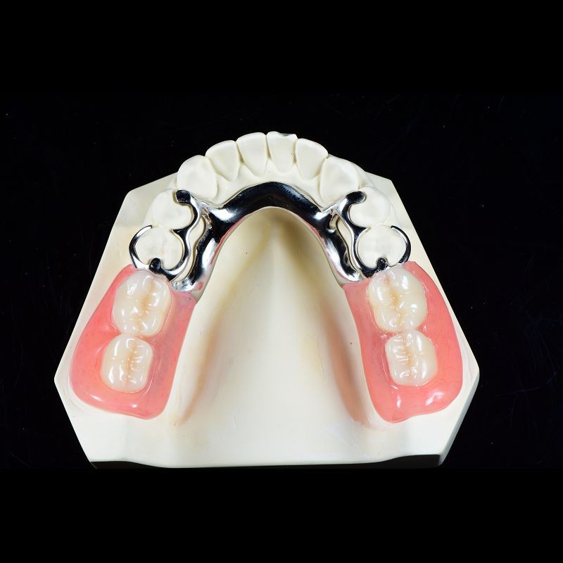 Co Cr Biocompatibile Metal Cast Framework Partial Dentures ODM