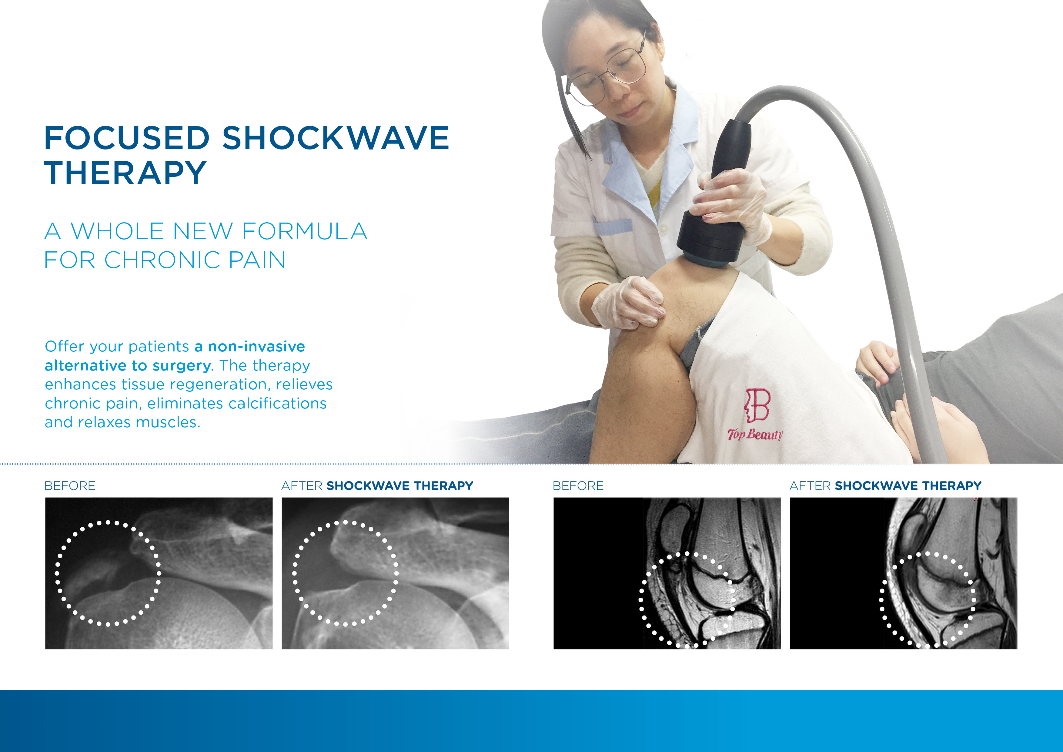 Professional Eswt Shock Wave Machine Eswt Shockwave Therapy Machine Erectile Dysfunction Treatment