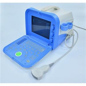 Quality Digital Portable Ultrasonic Diagnosis Equipment wholesale