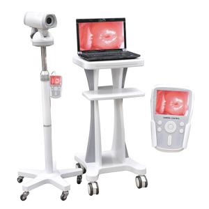 Quality Professional Video Colposcope Endoscope Gynaecology Colposcope CE03 wholesale