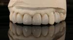 China Dental Lab Zirconia Full Contour Crown High Aesthetic Natural Dental