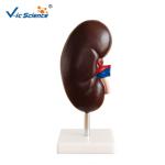 Medical Human Anatomical Model Plastic Kidney Anatomy Model 2 Parts VIC-310-2