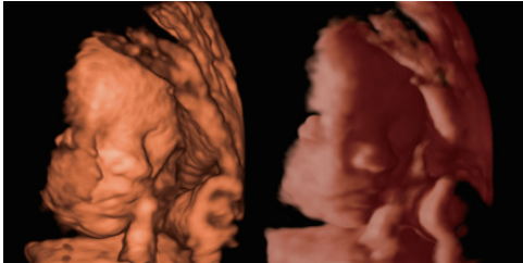 New design cardiac and 4d function Sonoscape P15 ultrasound for hospital