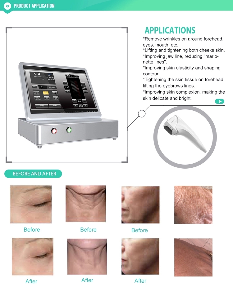 Effective 3D hifu face lifting machine/11 lines 3d hifu wrinkle removal machine for sell