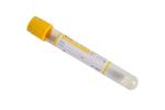 Convenient and Sterile Vacuum Blood Test Tube for Easy Blood Collection
