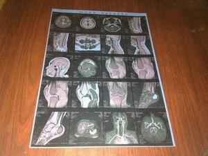 Quality Low Fog Medical X Ray Films , High Sharpness Konida X-ray Dry Film wholesale