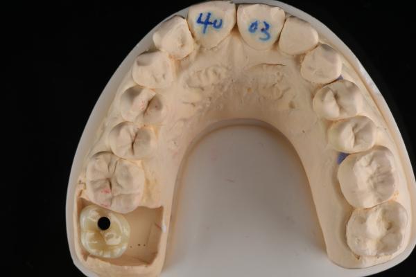 Professional Grade Dental Zirconia Hybrid Imitation Material Smooth Or Rough