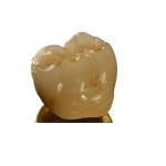 Inter Miscibility Porcelain Dental Crown